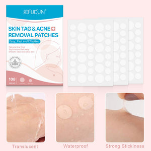 Acne Skin Tag Remover – Wart &amp; Blackhead Removal Patch for Flawless Skin