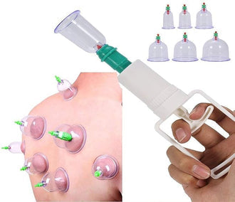 Intelligent Negative Pressure Cupping Massage Instrument