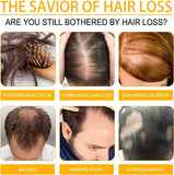 OUHOE Biotin Hair Growth Serum for Strong & Healthy Hair