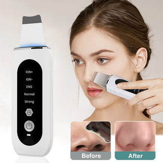 Pore Cleaning Device – Electric Blackhead Remover Vacuum for Deep Facial Cleansing