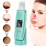 Pore Cleaning Device – Electric Blackhead Remover Vacuum for Deep Facial Cleansing